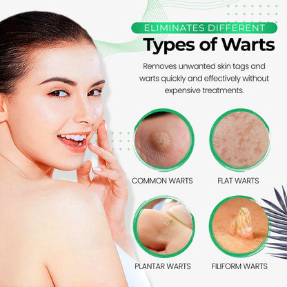 🧼South Moon  Wart Eliminator Soap